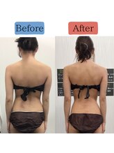 ステイゴールド美容整体院(STAY GOLD)/美容整体×ハイパーナイフ