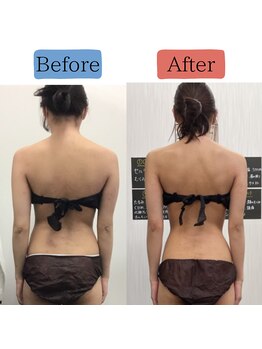 ステイゴールド美容整体院(STAY GOLD)/美容整体×ハイパーナイフ