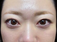 エイジレス(AGELESS)/ポイント→根元をしっかり上げる