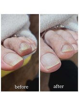 爪切り屋 足楽/