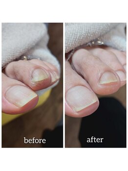 爪切り屋 足楽/