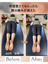 ウェルビーイング整体院 水戸赤塚店(wellbeing整体院)/Before After
