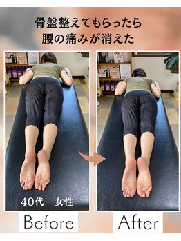 ウェルビーイング整体院 水戸赤塚店(wellbeing整体院)/Before After