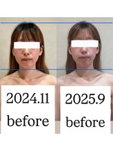 シェリーナ(cherieNa)/