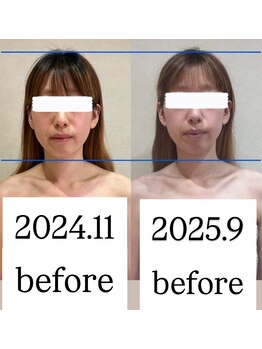 シェリーナ(cherieNa)/