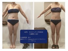 千歳の女神 刈谷店/Before/After