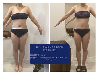 千歳の女神 刈谷店/Before/After