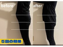 ヨサパーク ルナ(YOSA PARK)の雰囲気（驚きのリンパマッサージでみるみる細くなる感動体験！）