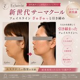 エクラヴィ(Eclatvie)