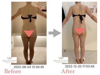 サロン ド カシェット 銀座/お客様のビフォーアフター例