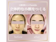 小顔美肌コルギ専門店 センティード 吉祥寺(Sentido)/