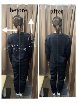 アイリー(Irie)/姿勢矯正