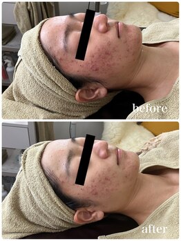 ジャスミン(Jasmin)/オーダーメイド高濃度原液導入