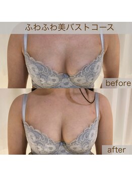 トータルビューティーサロン ティティ(Titi)/1度でバストアップが可能◎