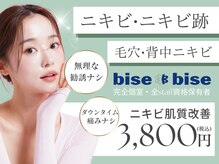 ビズビズ 梅田店(bisebise)
