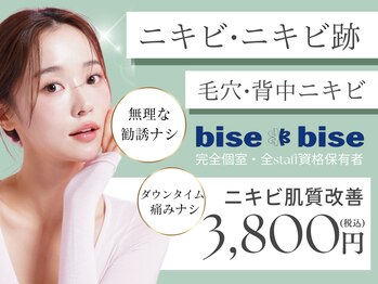 ビズビズ 梅田店(bisebise)