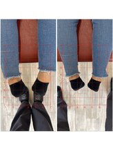 鍼灸サロン ヒマワリ(himawari)/骨盤矯正 左before 右after