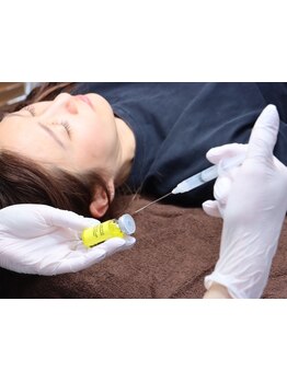 小顔になりたい