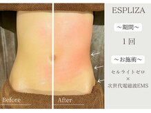 エスプライザ 横浜駅前店/1回で引き締まったお腹が手に！