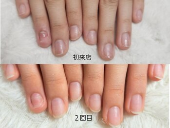 グレースレディ 大阪店/深爪/自爪育成/フィルイン