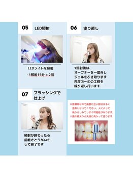 ティアナ 神栖店(Tiana)/プラチナホワイトニング 流れ3