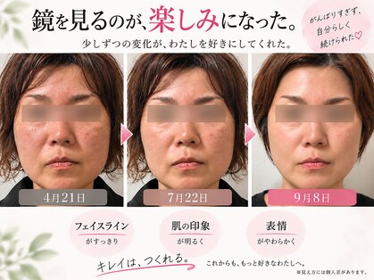 ヨサパーク ピオニー 二日市店(YOSA PARK Peony)の写真