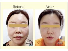 健康ハウス/フェイシャル