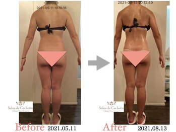 サロン ド カシェット 銀座/お客様のビフォーアフター例