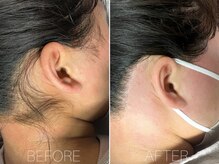 エヴァワックス 大阪 南堀江店(Eva Wax)/脱毛/ブラジリアンワックス