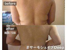 セレブリボーン 芦屋店の雰囲気（≪ごっそり！ムダ肉激落ち≫落ちにくい背中の贅肉もアプローチ！）