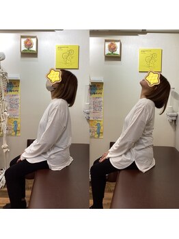 ヒデ整体院(Hide整体院)/首こり肩こり猫背巻き肩骨盤矯正