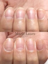 マリーロール 淀屋橋本店(Marie Laure)/自爪育成/深爪矯正/ネイルケア