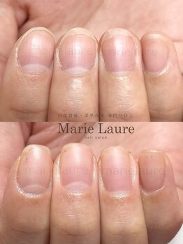 マリーロール 淀屋橋本店(Marie Laure)/自爪育成/深爪矯正/ネイルケア