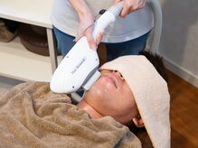 ひげ脱毛の様子