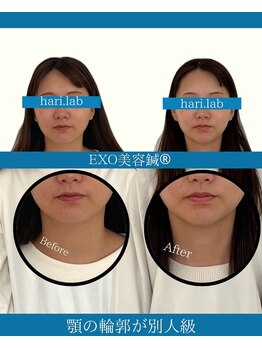 ハリラボ(hari Lab.)/【お客様の声】