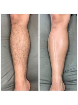 アレッド 大阪店(ared.)/夏が迫ってきました