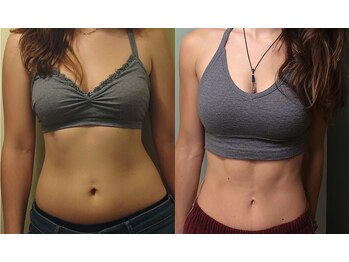 ヨサパーク 葵 坂東店(YOSA PARK Aoi)/ダイエット痩身・シェイプアップ