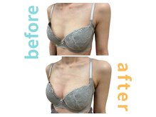 シエル(Ciel)/バストアップ施術１回