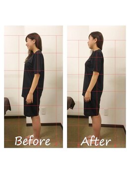 骨盤ストレッチ整体 b/姿勢矯正★変化写真