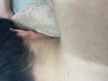 ナノハナ/鹿沼市全身脱毛美容室ナノハナ