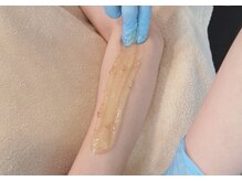 アンバー(unbar.)/シュガーリングとSHR脱毛