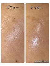 アトラ(Atora)/岡山初上陸☆韓国☆艶肌