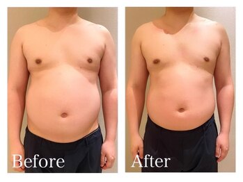 ククナ(KUKUNA)/*姿勢矯正*