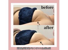 マシンを使ってバストを育てていきます！