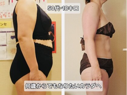 マナ(mana)の写真