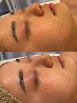 セレニテ(Serenite)/