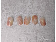 アルン 世田谷代田(Arun)/定額シンプルコース