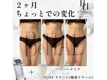 ビナル(BeNAL)/痩身☆ハイパーナイフB/A