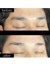 ユー 千葉駅前店(you)/症例写真