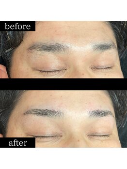 ユー 千葉駅前店(you)/症例写真